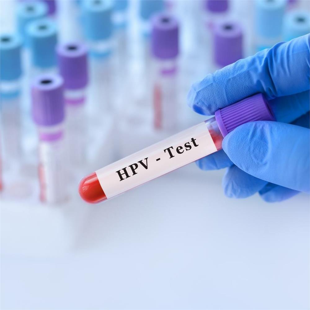 Analizli tıbbi test tüplerinin arka planında HPV testi içeren bir test kan örneği tüpü tutan doktor.